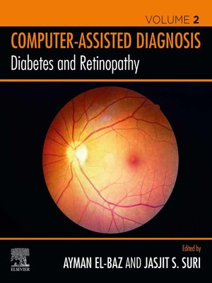 cover image of Diabetes and Retinopathy